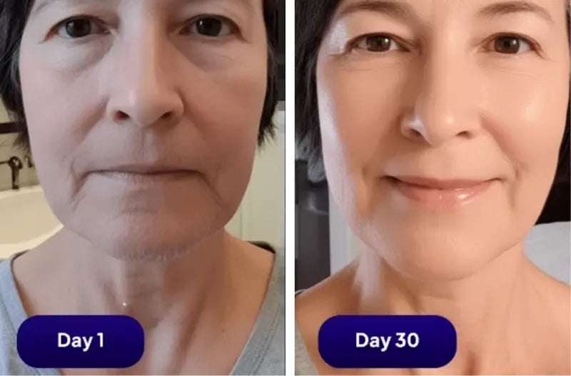 Margaret before and after