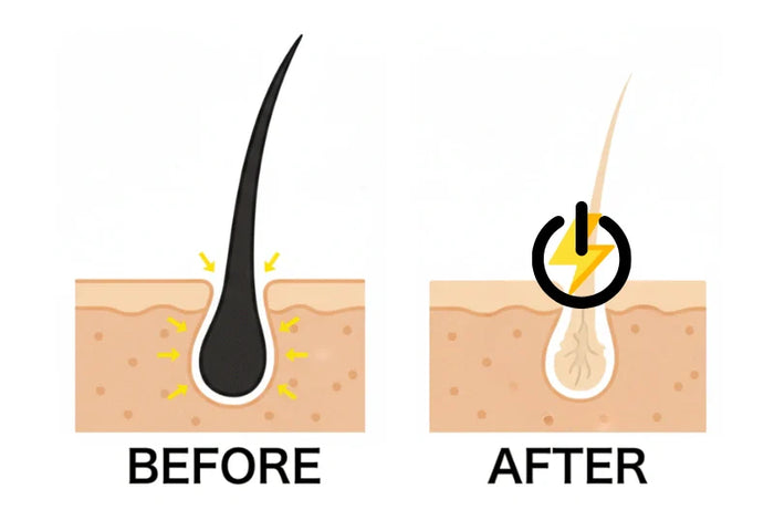 Before and after follicle